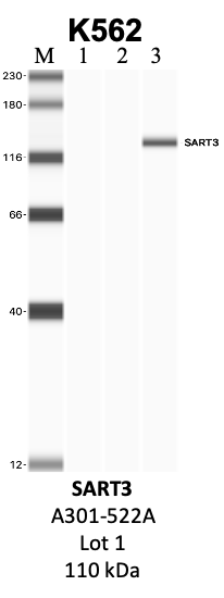 Bethyl_A301-522A_1_SART3.png<br>Caption: IP-WB analysis of K562 whole cell lysate using the SART3 specific antibody, A301-522A. Lanes 1 and 2 are 2.5% of five million whole cell lysate input and 50% of IP enrichment, respectively, using a normal IgG antibody. Lane 3 is 50% of IP enrichment from five million whole cell lysate using the SART3-specific antibody, A301-522A. The same antibody was used to detect protein levels via Western blot. This antibody passes preliminary validation and will be further pursued for secondary validation. *NOTE* Protein sizes are taken from Genecards.org and are only estimates based on sequence. Actual protein size may differ based on protein characteristics and electrophoresis method used.