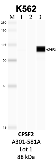 Bethyl_A301-581A_1_CPSF2.png<br>Caption: IP-WB analysis of K562 whole cell lysate using the CPSF2 specific antibody, A301-581A. Lanes 1 and 2 are 2.5% of five million whole cell lysate input and 50% of IP enrichment, respectively, using a normal IgG antibody. Lane 3 is 50% of IP enrichment from five million whole cell lysate using the CPSF2-specific antibody, A301-581A. The same antibody was used to detect protein levels via Western blot. This antibody passes preliminary validation and will be further pursued for secondary validation. *NOTE* Protein sizes are taken from Genecards.org and are only estimates based on sequence. Actual protein size may differ based on protein characteristics and electrophoresis method used.