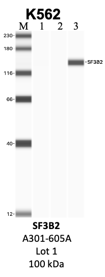 Bethyl_A301-605A_1_SF3B2.png<br>Caption: IP-WB analysis of K562 whole cell lysate using the SF3B2 specific antibody, A301-605A. Lanes 1 and 2 are 2.5% of five million whole cell lysate input and 50% of IP enrichment, respectively, using a normal IgG antibody. Lane 3 is 50% of IP enrichment from five million whole cell lysate using the SF3B2-specific antibody, A301-605A. The same antibody was used to detect protein levels via Western blot. This antibody passes preliminary validation and will be further pursued for secondary validation. *NOTE* Protein sizes are taken from Genecards.org and are only estimates based on sequence. Actual protein size may differ based on protein characteristics and electrophoresis method used.