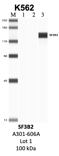 Bethyl_A301-606A_1_SF3B2.png<br>Caption: IP-WB analysis of K562 whole cell lysate using the SF3B2 specific antibody, A301-606A. Lanes 1 and 2 are 2.5% of five million whole cell lysate input and 50% of IP enrichment, respectively, using a normal IgG antibody. Lane 3 is 50% of IP enrichment from five million whole cell lysate using the SF3B2-specific antibody, A301-606A. The same antibody was used to detect protein levels via Western blot. This antibody passes preliminary validation and will be further pursued for secondary validation. *NOTE* Protein sizes are taken from Genecards.org and are only estimates based on sequence. Actual protein size may differ based on protein characteristics and electrophoresis method used.