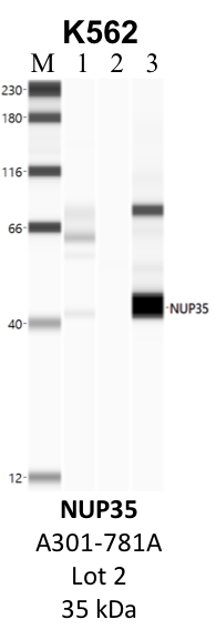 Bethyl_A301-781A_2_NUP35.png<br>Caption: IP-WB analysis of K562 whole cell lysate using the NUP35 specific antibody, A301-781A. Lane 1 is 2.5% of five million whole cell lysate input. Lanes 2 and 3 are 50% of IP enrichment from five million whole cell lysate using normal IgG antibody and the NUP35-specific antibody, A301-781A. The same antibody was used to detect protein levels via Western blot. This antibody passes preliminary validation and will be further pursued for secondary validation. *NOTE* Protein sizes are taken from Genecards.org and are only estimates based on sequence. Actual protein size may differ based on protein characteristics and electrophoresis method used.