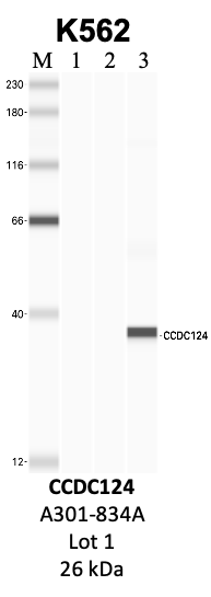 Bethyl_A301-834A_1_CCDC124.png<br>Caption: IP-WB analysis of K562 whole cell lysate using the CCDC124 specific antibody, A301-834A. Lanes 1 and 2 are 2.5% of five million whole cell lysate input and 50% of IP enrichment, respectively, using a normal IgG antibody. Lane 3 is 50% of IP enrichment from five million whole cell lysate using the CCDC124-specific antibody, A301-834A. The same antibody was used to detect protein levels via Western blot. This antibody passes preliminary validation and will be further pursued for secondary validation. *NOTE* Protein sizes are taken from Genecards.org and are only estimates based on sequence. Actual protein size may differ based on protein characteristics and electrophoresis method used.