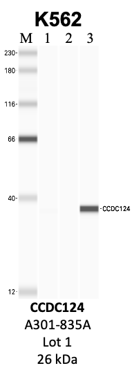 Bethyl_A301-835A_1_CCDC124.png<br>Caption: IP-WB analysis of K562 whole cell lysate using the CCDC124 specific antibody, A301-835A. Lanes 1 and 2 are 2.5% of five million whole cell lysate input and 50% of IP enrichment, respectively, using a normal IgG antibody. Lane 3 is 50% of IP enrichment from five million whole cell lysate using the CCDC124-specific antibody, A301-835A. The same antibody was used to detect protein levels via Western blot. This antibody passes preliminary validation and will be further pursued for secondary validation. *NOTE* Protein sizes are taken from Genecards.org and are only estimates based on sequence. Actual protein size may differ based on protein characteristics and electrophoresis method used.