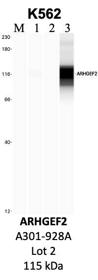 Bethyl_A301-928A_2_ARHGEF2.png<br>Caption: IP-WB analysis of K562 whole cell lysate using the ARHGEF2 specific antibody, A301-928A. Lanes 1 and 2 are 2.5% of five million whole cell lysate input and 50% of IP enrichment, respectively, using a normal IgG antibody. Lane 3 is 50% of IP enrichment from five million whole cell lysate using the ARHGEF2-specific antibody, A301-928A. The same antibody was used to detect protein levels via Western blot. This antibody passes preliminary validation and will be further pursued for secondary validation. *NOTE* Protein sizes are taken from Genecards.org and are only estimates based on sequence. Actual protein size may differ based on protein characteristics and electrophoresis method used.