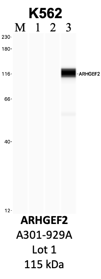 Bethyl_A301-929A_1_ARHGEF2.png<br>Caption: IP-WB analysis of K562 whole cell lysate using the ARHGEF2 specific antibody, A301-929A. Lanes 1 and 2 are 2.5% of five million whole cell lysate input and 50% of IP enrichment, respectively, using a normal IgG antibody. Lane 3 is 50% of IP enrichment from five million whole cell lysate using the ARHGEF2-specific antibody, A301-929A. The same antibody was used to detect protein levels via Western blot. This antibody passes preliminary validation and will be further pursued for secondary validation. *NOTE* Protein sizes are taken from Genecards.org and are only estimates based on sequence. Actual protein size may differ based on protein characteristics and electrophoresis method used.