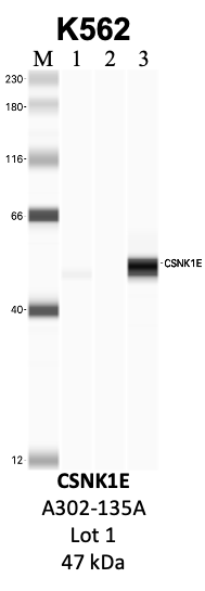 Bethyl_A302-135A_1_CSNK1E.png<br>Caption: IP-WB analysis of K562 whole cell lysate using the CSNK1E specific antibody, A302-135A. Lanes 1 and 2 are 2.5% of five million whole cell lysate input and 50% of IP enrichment, respectively, using a normal IgG antibody. Lane 3 is 50% of IP enrichment from five million whole cell lysate using the CSNK1E-specific antibody, A302-135A. The same antibody was used to detect protein levels via Western blot. This antibody passes preliminary validation and will be further pursued for secondary validation. *NOTE* Protein sizes are taken from Genecards.org and are only estimates based on sequence. Actual protein size may differ based on protein characteristics and electrophoresis method used.