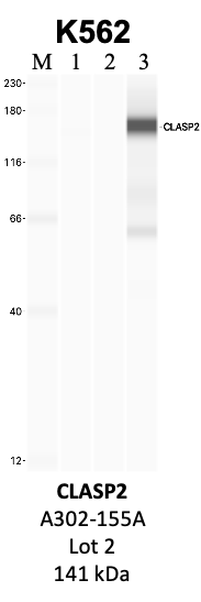 Bethyl_A302-155A_2_CLASP2.png<br>Caption: IP-WB analysis of K562 whole cell lysate using the CLASP2 specific antibody, A302-155A. Lanes 1 and 2 are 2.5% of five million whole cell lysate input and 50% of IP enrichment, respectively, using a normal IgG antibody. Lane 3 is 50% of IP enrichment from five million whole cell lysate using the CLASP2-specific antibody, A302-155A. The same antibody was used to detect protein levels via Western blot. This antibody passes preliminary validation and will be further pursued for secondary validation. *NOTE* Protein sizes are taken from Genecards.org and are only estimates based on sequence. Actual protein size may differ based on protein characteristics and electrophoresis method used.