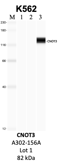 Bethyl_A302-156A_1_CNOT3.png<br>Caption: IP-WB analysis of K562 whole cell lysate using the CNOT3 specific antibody, A302-156A. Lanes 1 and 2 are 2.5% of five million whole cell lysate input and 50% of IP enrichment, respectively, using a normal IgG antibody. Lane 3 is 50% of IP enrichment from five million whole cell lysate using the CNOT3-specific antibody, A302-156A. The same antibody was used to detect protein levels via Western blot. This antibody passes preliminary validation and will be further pursued for secondary validation. *NOTE* Protein sizes are taken from Genecards.org and are only estimates based on sequence. Actual protein size may differ based on protein characteristics and electrophoresis method used.