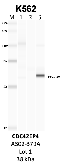 Bethyl_A302-379A_1_CDC42EP4.png<br>Caption: IP-WB analysis of K562 whole cell lysate using the CD3EAP specific antibody, A301-294A. Lanes 1 and 2 are 2.5% of five million whole cell lysate input and 50% of IP enrichment, respectively, using a normal IgG antibody. Lane 3 is 50% of IP enrichment from five million whole cell lysate using the CD3EAP-specific antibody, A301-294A. The same antibody was used to detect protein levels via Western blot. This antibody passes preliminary validation and will be further pursued for secondary validation. *NOTE* Protein sizes are taken from Genecards.org and are only estimates based on sequence. Actual protein size may differ based on protein characteristics and electrophoresis method used.