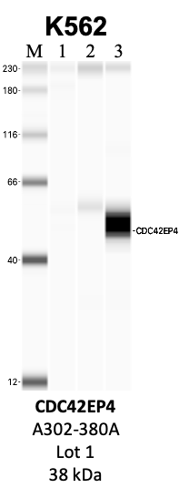 Bethyl_A302-380A_1_CDC42EP4.png<br>Caption: IP-WB analysis of K562 whole cell lysate using the CDC42EP4 specific antibody, A302-380A. Lanes 1 and 2 are 2.5% of five million whole cell lysate input and 50% of IP enrichment, respectively, using a normal IgG antibody. Lane 3 is 50% of IP enrichment from five million whole cell lysate using the CDC42EP4-specific antibody, A302-380A. The same antibody was used to detect protein levels via Western blot. This antibody passes preliminary validation and will be further pursued for secondary validation. *NOTE* Protein sizes are taken from Genecards.org and are only estimates based on sequence. Actual protein size may differ based on protein characteristics and electrophoresis method used.