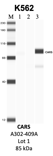 Bethyl_A302-409A_1_CARS.png<br>Caption: IP-WB analysis of K562 whole cell lysate using the CARS specific antibody, A302-409A. Lanes 1 and 2 are 2.5% of five million whole cell lysate input and 50% of IP enrichment, respectively, using a normal IgG antibody. Lane 3 is 50% of IP enrichment from five million whole cell lysate using the CARS-specific antibody, A302-409A. The same antibody was used to detect protein levels via Western blot. This antibody passes preliminary validation and will be further pursued for secondary validation. *NOTE* Protein sizes are taken from Genecards.org and are only estimates based on sequence. Actual protein size may differ based on protein characteristics and electrophoresis method used.