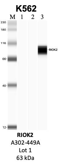 Bethyl_A302-449A_1_RIOK2.png<br>Caption: IP-WB analysis of K562 whole cell lysate using the RIOK2 specific antibody, A302-449A. Lanes 1 and 2 are 2.5% of five million whole cell lysate input and 50% of IP enrichment, respectively, using a normal IgG antibody. Lane 3 is 50% of IP enrichment from five million whole cell lysate using the RIOK2-specific antibody, A302-449A. The same antibody was used to detect protein levels via Western blot. This antibody passes preliminary validation and will be further pursued for secondary validation. *NOTE* Protein sizes are taken from Genecards.org and are only estimates based on sequence. Actual protein size may differ based on protein characteristics and electrophoresis method used.