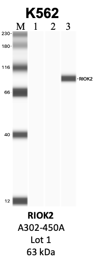 Bethyl_A302-450A_1_RIOK2.png<br>Caption: IP-WB analysis of K562 whole cell lysate using the RIOK2 specific antibody, A302-450A. Lanes 1 and 2 are 2.5% of five million whole cell lysate input and 50% of IP enrichment, respectively, using a normal IgG antibody. Lane 3 is 50% of IP enrichment from five million whole cell lysate using the RIOK2-specific antibody, A302-450A. The same antibody was used to detect protein levels via Western blot. This antibody passes preliminary validation and will be further pursued for secondary validation. *NOTE* Protein sizes are taken from Genecards.org and are only estimates based on sequence. Actual protein size may differ based on protein characteristics and electrophoresis method used.