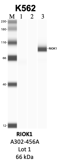 Bethyl_A302-456A_1_RIOK1.png<br>Caption: IP-WB analysis of K562 whole cell lysate using the RIOK1 specific antibody, A302-456A. Lanes 1 and 2 are 2.5% of five million whole cell lysate input and 50% of IP enrichment, respectively, using a normal IgG antibody. Lane 3 is 50% of IP enrichment from five million whole cell lysate using the RIOK1-specific antibody, A302-456A. The same antibody was used to detect protein levels via Western blot. This antibody passes preliminary validation and will be further pursued for secondary validation. *NOTE* Protein sizes are taken from Genecards.org and are only estimates based on sequence. Actual protein size may differ based on protein characteristics and electrophoresis method used.