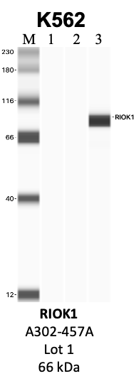 Bethyl_A302-457A_1_RIOK1.png<br>Caption: IP-WB analysis of K562 whole cell lysate using the RIOK1 specific antibody, A302-457A. Lanes 1 and 2 are 2.5% of five million whole cell lysate input and 50% of IP enrichment, respectively, using a normal IgG antibody. Lane 3 is 50% of IP enrichment from five million whole cell lysate using the RIOK1-specific antibody, A302-457A. The same antibody was used to detect protein levels via Western blot. This antibody passes preliminary validation and will be further pursued for secondary validation. *NOTE* Protein sizes are taken from Genecards.org and are only estimates based on sequence. Actual protein size may differ based on protein characteristics and electrophoresis method used.