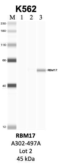 Bethyl_A302-497A_2_RBM17.png<br>Caption: IP-WB analysis of K562 whole cell lysate using the RBM17 specific antibody, A302-497A. Lanes 1 and 2 are 2.5% of five million whole cell lysate input and 50% of IP enrichment, respectively, using a normal IgG antibody. Lane 3 is 50% of IP enrichment from five million whole cell lysate using the RBM17-specific antibody, A302-497A. The same antibody was used to detect protein levels via Western blot. This antibody passes preliminary validation and will be further pursued for secondary validation. *NOTE* Protein sizes are taken from Genecards.org and are only estimates based on sequence. Actual protein size may differ based on protein characteristics and electrophoresis method used.