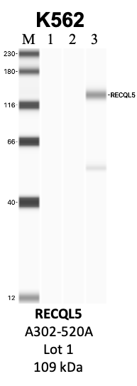 Bethyl_A302-520A_1_RECQL5.png<br>Caption: IP-WB analysis of K562 whole cell lysate using the RECQL5 specific antibody, A302-520A. Lanes 1 and 2 are 2.5% of five million whole cell lysate input and 50% of IP enrichment, respectively, using a normal IgG antibody. Lane 3 is 50% of IP enrichment from five million whole cell lysate using the RECQL5-specific antibody, A302-520A. The same antibody was used to detect protein levels via Western blot. This antibody passes preliminary validation and will be further pursued for secondary validation. *NOTE* Protein sizes are taken from Genecards.org and are only estimates based on sequence. Actual protein size may differ based on protein characteristics and electrophoresis method used.