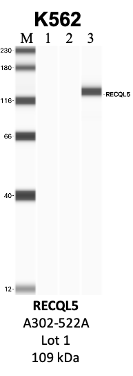 Bethyl_A302-522A_1_RECQL5.png<br>Caption: IP-WB analysis of K562 whole cell lysate using the RECQL5 specific antibody, A302-522A. Lanes 1 and 2 are 2.5% of five million whole cell lysate input and 50% of IP enrichment, respectively, using a normal IgG antibody. Lane 3 is 50% of IP enrichment from five million whole cell lysate using the RECQL5-specific antibody, A302-522A. The same antibody was used to detect protein levels via Western blot. This antibody passes preliminary validation and will be further pursued for secondary validation. *NOTE* Protein sizes are taken from Genecards.org and are only estimates based on sequence. Actual protein size may differ based on protein characteristics and electrophoresis method used.