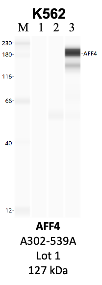 Bethyl_A302-539A_1_AFF4.png<br>Caption: IP-WB analysis of K562 whole cell lysate using the AFF4 specific antibody, A302-539A. Lanes 1 and 2 are 2.5% of five million whole cell lysate input and 50% of IP enrichment, respectively, using a normal IgG antibody. Lane 3 is 50% of IP enrichment from five million whole cell lysate using the AFF4-specific antibody, A302-539A. The same antibody was used to detect protein levels via Western blot. This antibody passes preliminary validation and will be further pursued for secondary validation. *NOTE* Protein sizes are taken from Genecards.org and are only estimates based on sequence. Actual protein size may differ based on protein characteristics and electrophoresis method used.