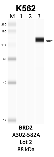 Bethyl_A302-582A_2_BRD2.png<br>Caption: IP-WB analysis of K562 whole cell lysate using the BRD2 specific antibody, A302-582A. Lanes 1 and 2 are 2.5% of five million whole cell lysate input and 50% of IP enrichment, respectively, using a normal IgG antibody. Lane 3 is 50% of IP enrichment from five million whole cell lysate using the BRD2-specific antibody, A302-582A. The same antibody was used to detect protein levels via Western blot. This antibody passes preliminary validation and will be further pursued for secondary validation. *NOTE* Protein sizes are taken from Genecards.org and are only estimates based on sequence. Actual protein size may differ based on protein characteristics and electrophoresis method used.