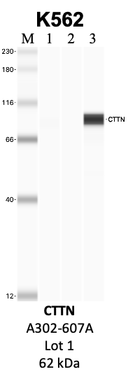 Bethyl_A302-607A_1_CTTN.png<br>Caption: IP-WB analysis of K562 whole cell lysate using the CTTN specific antibody, A302-607A. Lanes 1 and 2 are 2.5% of five million whole cell lysate input and 50% of IP enrichment, respectively, using a normal IgG antibody. Lane 3 is 50% of IP enrichment from five million whole cell lysate using the CTTN-specific antibody, A302-607A. The same antibody was used to detect protein levels via Western blot. This antibody passes preliminary validation and will be further pursued for secondary validation. *NOTE* Protein sizes are taken from Genecards.org and are only estimates based on sequence. Actual protein size may differ based on protein characteristics and electrophoresis method used.