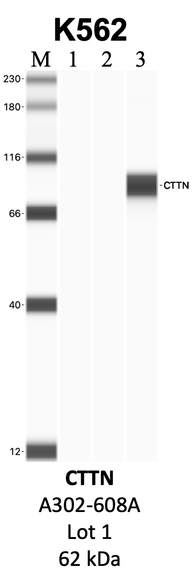 Bethyl_A302-608A_1_CTTN.png<br>Caption: IP-WB analysis of K562 whole cell lysate using the CTTN specific antibody, A302-608A. Lanes 1 and 2 are 2.5% of five million whole cell lysate input and 50% of IP enrichment, respectively, using a normal IgG antibody. Lane 3 is 50% of IP enrichment from five million whole cell lysate using the CTTN-specific antibody, A302-608A. The same antibody was used to detect protein levels via Western blot. This antibody passes preliminary validation and will be further pursued for secondary validation. *NOTE* Protein sizes are taken from Genecards.org and are only estimates based on sequence. Actual protein size may differ based on protein characteristics and electrophoresis method used.