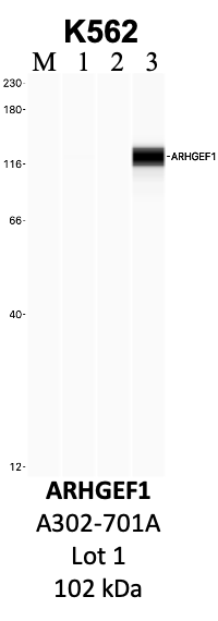 Bethyl_A302-701A_1_ARHGEF1.png<br>Caption: IP-WB analysis of K562 whole cell lysate using the ARHGEF1 specific antibody, A302-701A. Lanes 1 and 2 are 2.5% of five million whole cell lysate input and 50% of IP enrichment, respectively, using a normal IgG antibody. Lane 3 is 50% of IP enrichment from five million whole cell lysate using the ARHGEF1-specific antibody, A302-701A. The same antibody was used to detect protein levels via Western blot. This antibody passes preliminary validation and will be further pursued for secondary validation. *NOTE* Protein sizes are taken from Genecards.org and are only estimates based on sequence. Actual protein size may differ based on protein characteristics and electrophoresis method used.