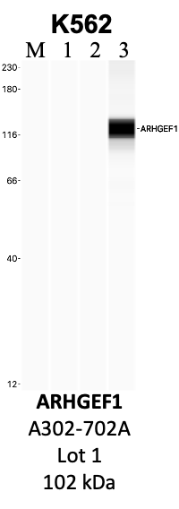 Bethyl_A302-702A_1_ARHGEF1.png<br>Caption: IP-WB analysis of K562 whole cell lysate using the ARHGEF1 specific antibody, A302-702A. Lanes 1 and 2 are 2.5% of five million whole cell lysate input and 50% of IP enrichment, respectively, using a normal IgG antibody. Lane 3 is 50% of IP enrichment from five million whole cell lysate using the ARHGEF1-specific antibody, A302-702A. The same antibody was used to detect protein levels via Western blot. This antibody passes preliminary validation and will be further pursued for secondary validation. *NOTE* Protein sizes are taken from Genecards.org and are only estimates based on sequence. Actual protein size may differ based on protein characteristics and electrophoresis method used.