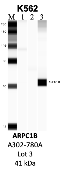 Bethyl_A302-780A_3_ARPC1B.png<br>Caption: IP-WB analysis of K562 whole cell lysate using the ARPC1B specific antibody, A302-780A. Lanes 1 and 2 are 2.5% of five million whole cell lysate input and 50% of IP enrichment, respectively, using a normal IgG antibody. Lane 3 is 50% of IP enrichment from five million whole cell lysate using the ARPC1B-specific antibody, A302-780A. The same antibody was used to detect protein levels via Western blot. This antibody passes preliminary validation and will be further pursued for secondary validation. *NOTE* Protein sizes are taken from Genecards.org and are only estimates based on sequence. Actual protein size may differ based on protein characteristics and electrophoresis method used.