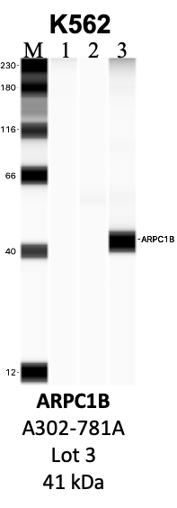 Bethyl_A302-781A_3_ARPC1B.png<br>Caption: IP-WB analysis of K562 whole cell lysate using the ARPC1B specific antibody, A302-781A. Lanes 1 and 2 are 2.5% of five million whole cell lysate input and 50% of IP enrichment, respectively, using a normal IgG antibody. Lane 3 is 50% of IP enrichment from five million whole cell lysate using the ARPC1B-specific antibody, A302-781A. The same antibody was used to detect protein levels via Western blot. This antibody passes preliminary validation and will be further pursued for secondary validation. *NOTE* Protein sizes are taken from Genecards.org and are only estimates based on sequence. Actual protein size may differ based on protein characteristics and electrophoresis method used.