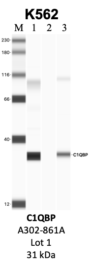 Bethyl_A302-861A_1_C1QBP.png<br>Caption: IP-WB analysis of K562 whole cell lysate using the C1QBP specific antibody, A302-861A. Lanes 1 and 2 are 2.5% of five million whole cell lysate input and 50% of IP enrichment, respectively, using a normal IgG antibody. Lane 3 is 50% of IP enrichment from five million whole cell lysate using the C1QBP-specific antibody, A302-861A. The same antibody was used to detect protein levels via Western blot. This antibody passes preliminary validation and will be further pursued for secondary validation. *NOTE* Protein sizes are taken from Genecards.org and are only estimates based on sequence. Actual protein size may differ based on protein characteristics and electrophoresis method used.