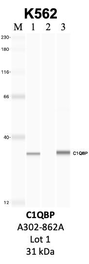 Bethyl_A302-862A_1_C1QBP.png<br>Caption: IP-WB analysis of K562 whole cell lysate using the C1QBP specific antibody, A302-862A. Lanes 1 and 2 are 2.5% of five million whole cell lysate input and 50% of IP enrichment, respectively, using a normal IgG antibody. Lane 3 is 50% of IP enrichment from five million whole cell lysate using the C1QBP-specific antibody, A302-862A. The same antibody was used to detect protein levels via Western blot. This antibody passes preliminary validation and will be further pursued for secondary validation. *NOTE* Protein sizes are taken from Genecards.org and are only estimates based on sequence. Actual protein size may differ based on protein characteristics and electrophoresis method used.