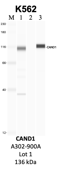 Bethyl_A302-900A_1_CAND1.png<br>Caption: IP-WB analysis of K562 whole cell lysate using the CAND1 specific antibody, A302-900A. Lanes 1 and 2 are 2.5% of five million whole cell lysate input and 50% of IP enrichment, respectively, using a normal IgG antibody. Lane 3 is 50% of IP enrichment from five million whole cell lysate using the CAND1-specific antibody, A302-900A. The same antibody was used to detect protein levels via Western blot. This antibody passes preliminary validation and will be further pursued for secondary validation. *NOTE* Protein sizes are taken from Genecards.org and are only estimates based on sequence. Actual protein size may differ based on protein characteristics and electrophoresis method used.