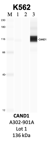 Bethyl_A302-901A_1_CAND1.png<br>Caption: IP-WB analysis of K562 whole cell lysate using the CAND1 specific antibody, A302-901A. Lanes 1 and 2 are 2.5% of five million whole cell lysate input and 50% of IP enrichment, respectively, using a normal IgG antibody. Lane 3 is 50% of IP enrichment from five million whole cell lysate using the CAND1-specific antibody, A302-901A. The same antibody was used to detect protein levels via Western blot. This antibody passes preliminary validation and will be further pursued for secondary validation. *NOTE* Protein sizes are taken from Genecards.org and are only estimates based on sequence. Actual protein size may differ based on protein characteristics and electrophoresis method used.