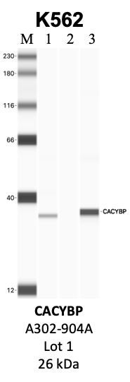 Bethyl_A302-904A_1_CACYBP.png<br>Caption: IP-WB analysis of K562 whole cell lysate using the CACYBP specific antibody, A302-904A. Lanes 1 and 2 are 2.5% of five million whole cell lysate input and 50% of IP enrichment, respectively, using a normal IgG antibody. Lane 3 is 50% of IP enrichment from five million whole cell lysate using the CACYBP-specific antibody, A302-904A. The same antibody was used to detect protein levels via Western blot. This antibody passes preliminary validation and will be further pursued for secondary validation. *NOTE* Protein sizes are taken from Genecards.org and are only estimates based on sequence. Actual protein size may differ based on protein characteristics and electrophoresis method used.