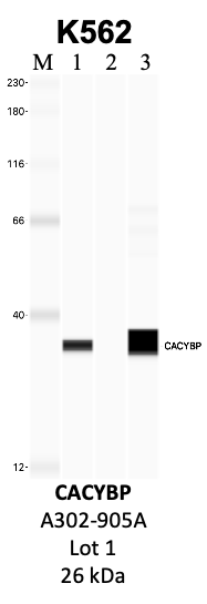 Bethyl_A302-905A_1_CACYBP.png<br>Caption: IP-WB analysis of K562 whole cell lysate using the CACYBP specific antibody, A302-905A. Lanes 1 and 2 are 2.5% of five million whole cell lysate input and 50% of IP enrichment, respectively, using a normal IgG antibody. Lane 3 is 50% of IP enrichment from five million whole cell lysate using the CACYBP-specific antibody, A302-905A. The same antibody was used to detect protein levels via Western blot. This antibody passes preliminary validation and will be further pursued for secondary validation. *NOTE* Protein sizes are taken from Genecards.org and are only estimates based on sequence. Actual protein size may differ based on protein characteristics and electrophoresis method used.