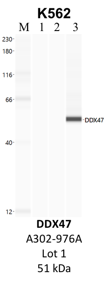 Bethyl_A302-976A_1_DDX47.png<br>Caption: IP-WB analysis of K562 whole cell lysate using the DDX47 specific antibody, A302-976A. Lane 1 is 2.5% of five million whole cell lysate input. Lanes 2 and 3 are 50% of IP enrichment from five million whole cell lysate using normal IgG antibody and the DDX47-specific antibody, A302-976A. The same antibody was used to detect protein levels via Western blot. This antibody passes preliminary validation and will be further pursued for secondary validation. *NOTE* Protein sizes are taken from Genecards.org and are only estimates based on sequence. Actual protein size may differ based on protein characteristics and electrophoresis method used.