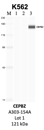 Bethyl_A303-154A_1_CEBPZ.png<br>Caption: IP-WB analysis of K562 whole cell lysate using the CEBPZ specific antibody, A303-154A. Lanes 1 and 2 are 2.5% of five million whole cell lysate input and 50% of IP enrichment, respectively, using a normal IgG antibody. Lane 3 is 50% of IP enrichment from five million whole cell lysate using the CEBPZ-specific antibody, A303-154A. The same antibody was used to detect protein levels via Western blot. This antibody passes preliminary validation and will be further pursued for secondary validation. *NOTE* Protein sizes are taken from Genecards.org and are only estimates based on sequence. Actual protein size may differ based on protein characteristics and electrophoresis method used.