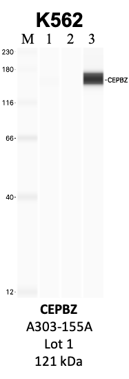 Bethyl_A303-155A_1_CEBPZ.png<br>Caption: IP-WB analysis of K562 whole cell lysate using the CEBPZ specific antibody, A303-155A. Lanes 1 and 2 are 2.5% of five million whole cell lysate input and 50% of IP enrichment, respectively, using a normal IgG antibody. Lane 3 is 50% of IP enrichment from five million whole cell lysate using the CEBPZ-specific antibody, A303-155A. The same antibody was used to detect protein levels via Western blot. This antibody passes preliminary validation and will be further pursued for secondary validation. *NOTE* Protein sizes are taken from Genecards.org and are only estimates based on sequence. Actual protein size may differ based on protein characteristics and electrophoresis method used.