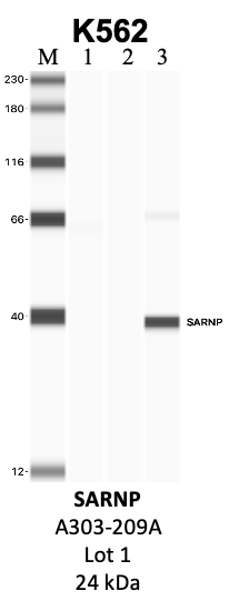 Bethyl_A303-209A_1_SARNP.png<br>Caption: IP-WB analysis of K562 whole cell lysate using the SARNP specific antibody, A303-209A. Lanes 1 and 2 are 2.5% of five million whole cell lysate input and 50% of IP enrichment, respectively, using a normal IgG antibody. Lane 3 is 50% of IP enrichment from five million whole cell lysate using the SARNP-specific antibody, A303-209A. The same antibody was used to detect protein levels via Western blot. This antibody passes preliminary validation and will be further pursued for secondary validation. *NOTE* Protein sizes are taken from Genecards.org and are only estimates based on sequence. Actual protein size may differ based on protein characteristics and electrophoresis method used.