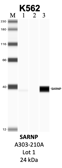 Bethyl_A303-210A_1_SARNP.png<br>Caption: IP-WB analysis of K562 whole cell lysate using the SARNP specific antibody, A303-210A. Lanes 1 and 2 are 2.5% of five million whole cell lysate input and 50% of IP enrichment, respectively, using a normal IgG antibody. Lane 3 is 50% of IP enrichment from five million whole cell lysate using the SARNP-specific antibody, A303-210A. The same antibody was used to detect protein levels via Western blot. This antibody passes preliminary validation and will be further pursued for secondary validation. *NOTE* Protein sizes are taken from Genecards.org and are only estimates based on sequence. Actual protein size may differ based on protein characteristics and electrophoresis method used.