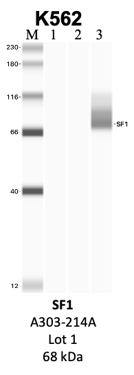 Bethyl_A303-214A_1_SF1.png<br>Caption: IP-WB analysis of K562 whole cell lysate using the SF1 specific antibody, A303-214A. Lanes 1 and 2 are 2.5% of five million whole cell lysate input and 50% of IP enrichment, respectively, using a normal IgG antibody. Lane 3 is 50% of IP enrichment from five million whole cell lysate using the SF1-specific antibody, A303-214A. The same antibody was used to detect protein levels via Western blot. This antibody passes preliminary validation and will be further pursued for secondary validation. *NOTE* Protein sizes are taken from Genecards.org and are only estimates based on sequence. Actual protein size may differ based on protein characteristics and electrophoresis method used.