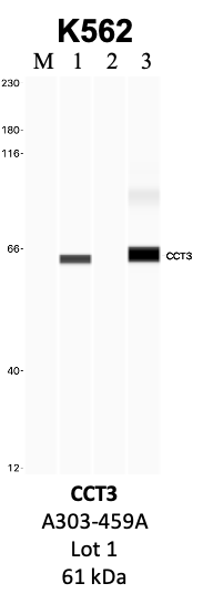 Bethyl_A303-459A_1_CCT3.png<br>Caption: IP-WB analysis of K562 whole cell lysate using the CCT3 specific antibody, A303-459A. Lanes 1 and 2 are 2.5% of five million whole cell lysate input and 50% of IP enrichment, respectively, using a normal IgG antibody. Lane 3 is 50% of IP enrichment from five million whole cell lysate using the CCT3-specific antibody, A303-459A. The same antibody was used to detect protein levels via Western blot. This antibody passes preliminary validation and will be further pursued for secondary validation. *NOTE* Protein sizes are taken from Genecards.org and are only estimates based on sequence. Actual protein size may differ based on protein characteristics and electrophoresis method used.