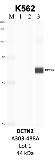 Bethyl_A303-488A_1_DCTN2.png<br>Caption: IP-WB analysis of K562 whole cell lysate using the DCTN2 specific antibody, A303-488A. Lanes 1 and 2 are 2.5% of five million whole cell lysate input and 50% of IP enrichment, respectively, using a normal IgG antibody. Lane 3 is 50% of IP enrichment from five million whole cell lysate using the DCTN2-specific antibody, A303-488A. The same antibody was used to detect protein levels via Western blot. This antibody passes preliminary validation and will be further pursued for secondary validation. *NOTE* Protein sizes are taken from Genecards.org and are only estimates based on sequence. Actual protein size may differ based on protein characteristics and electrophoresis method used.