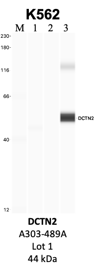 Bethyl_A303-489A_1_DCTN2.png<br>Caption: IP-WB analysis of K562 whole cell lysate using the DCTN2 specific antibody, A303-489A. Lanes 1 and 2 are 2.5% of five million whole cell lysate input and 50% of IP enrichment, respectively, using a normal IgG antibody. Lane 3 is 50% of IP enrichment from five million whole cell lysate using the DCTN2-specific antibody, A303-489A. The same antibody was used to detect protein levels via Western blot. This antibody passes preliminary validation and will be further pursued for secondary validation. *NOTE* Protein sizes are taken from Genecards.org and are only estimates based on sequence. Actual protein size may differ based on protein characteristics and electrophoresis method used.