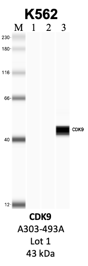 Bethyl_A303-493A_1_CDK9.png<br>Caption: IP-WB analysis of K562 whole cell lysate using the CDK9 specific antibody, A303-493A. Lanes 1 and 2 are 2.5% of five million whole cell lysate input and 50% of IP enrichment, respectively, using a normal IgG antibody. Lane 3 is 50% of IP enrichment from five million whole cell lysate using the CDK9-specific antibody, A303-493A. The same antibody was used to detect protein levels via Western blot. This antibody passes preliminary validation and will be further pursued for secondary validation. *NOTE* Protein sizes are taken from Genecards.org and are only estimates based on sequence. Actual protein size may differ based on protein characteristics and electrophoresis method used.