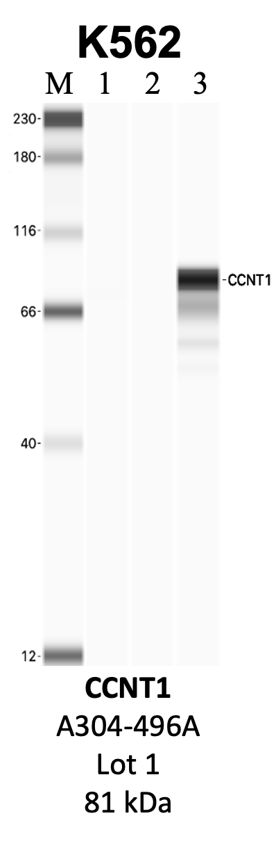 Bethyl_A303-496A_1_CCNT1.png<br>Caption: IP-WB analysis of K562 whole cell lysate using the CCNT1 specific antibody, A303-496A. Lanes 1 and 2 are 2.5% of five million whole cell lysate input and 50% of IP enrichment, respectively, using a normal IgG antibody. Lane 3 is 50% of IP enrichment from five million whole cell lysate using the CCNT1-specific antibody, A303-496A. The same antibody was used to detect protein levels via Western blot. This antibody passes preliminary validation and will be further pursued for secondary validation. *NOTE* Protein sizes are taken from Genecards.org and are only estimates based on sequence. Actual protein size may differ based on protein characteristics and electrophoresis method used.