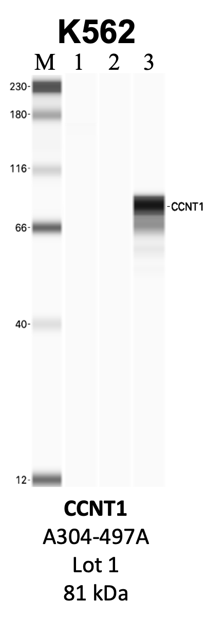 Bethyl_A303-497A_1_CCNT1.png<br>Caption: IP-WB analysis of K562 whole cell lysate using the CCNT1 specific antibody, A303-497A. Lanes 1 and 2 are 2.5% of five million whole cell lysate input and 50% of IP enrichment, respectively, using a normal IgG antibody. Lane 3 is 50% of IP enrichment from five million whole cell lysate using the CCNT1-specific antibody, A303-497A. The same antibody was used to detect protein levels via Western blot. This antibody passes preliminary validation and will be further pursued for secondary validation. *NOTE* Protein sizes are taken from Genecards.org and are only estimates based on sequence. Actual protein size may differ based on protein characteristics and electrophoresis method used.