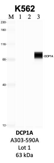 Bethyl_A303-590A_1_DCP1A.png<br>Caption: IP-WB analysis of K562 whole cell lysate using the DCP1A specific antibody, A303-590A. Lanes 1 and 2 are 2.5% of five million whole cell lysate input and 50% of IP enrichment, respectively, using a normal IgG antibody. Lane 3 is 50% of IP enrichment from five million whole cell lysate using the DCP1A-specific antibody, A303-590A. The same antibody was used to detect protein levels via Western blot. This antibody passes preliminary validation and will be further pursued for secondary validation. *NOTE* Protein sizes are taken from Genecards.org and are only estimates based on sequence. Actual protein size may differ based on protein characteristics and electrophoresis method used.