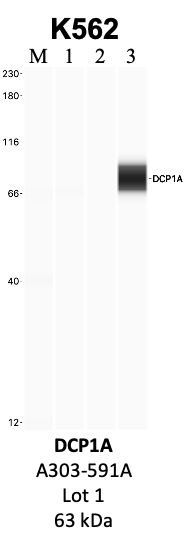 Bethyl_A303-591A_1_DCP1A.png<br>Caption: IP-WB analysis of K562 whole cell lysate using the DCP1A specific antibody, A303-591A. Lanes 1 and 2 are 2.5% of five million whole cell lysate input and 50% of IP enrichment, respectively, using a normal IgG antibody. Lane 3 is 50% of IP enrichment from five million whole cell lysate using the DCP1A-specific antibody, A303-591A. The same antibody was used to detect protein levels via Western blot. This antibody passes preliminary validation and will be further pursued for secondary validation. *NOTE* Protein sizes are taken from Genecards.org and are only estimates based on sequence. Actual protein size may differ based on protein characteristics and electrophoresis method used.